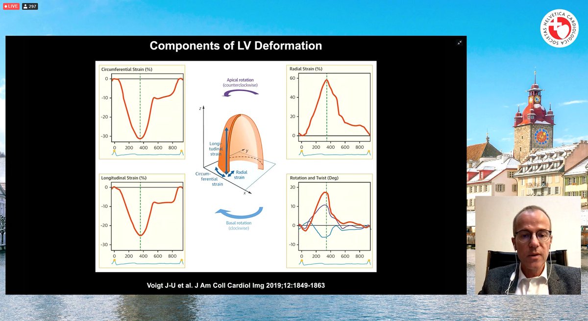 SwissCardio's tweet image. #StrainAnalysis highlights by Prof. Tanner:
❤️Several factors can affect SA: software, operator, loop / tracking quality, &amp;amp; #experience.
❤️SA doesn't consider loading condt.
❤️There is lower variability in SA than #LVEF measmnt.
❤️norm. values are getting well defined.
#EchoFirst
