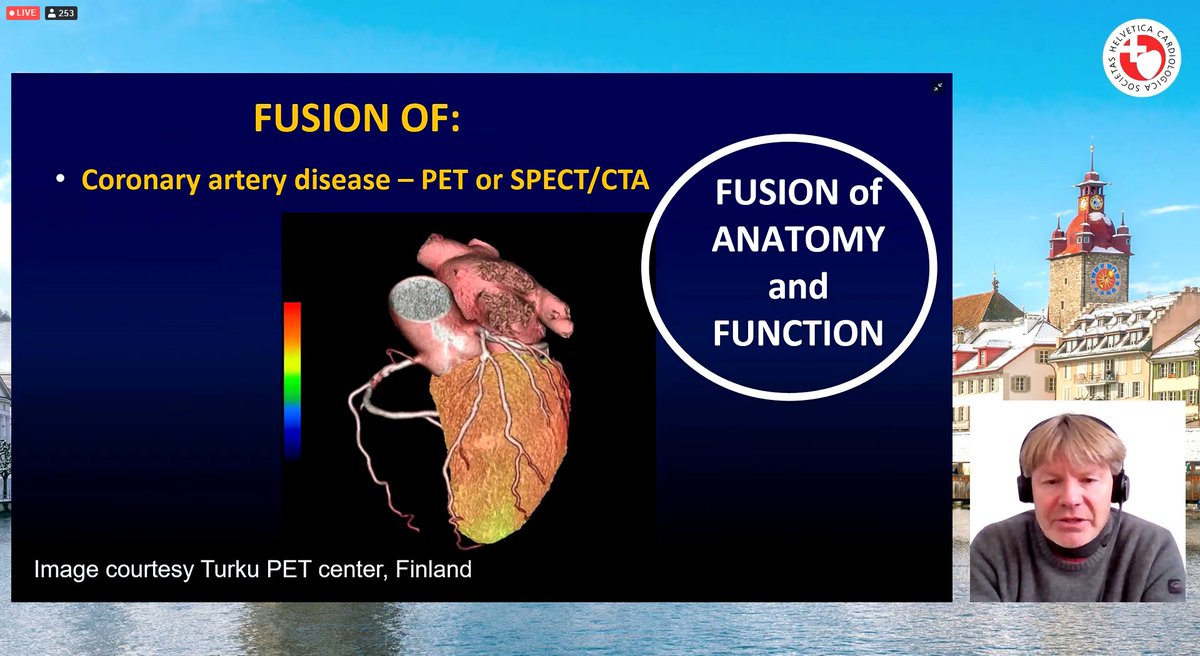 SwissCardio's tweet image. #Deformation/#FusionImaging highlights - Prof. Bax: 1/2
❤️Understanding any disease requires assessment of anatomy, function, and presence of inflammation. 
❤️Fusion of different imaging modalities that provides such info allow better understanding of disease status.
@SwissCardio