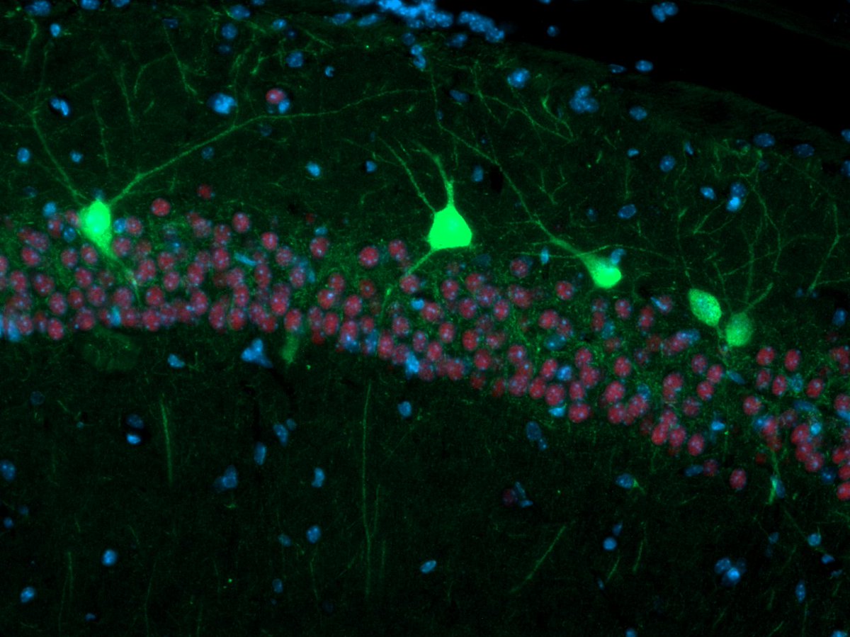 Members of the #premstem team from <a href="/UMCUtrecht/">UMC Utrecht</a> have co-authored the findings of a study investigating whether mesenchymal #stemcells (MSCs) aid interneuron development following premature birth.

➡️ mdpi.com/1422-0067/22/1…