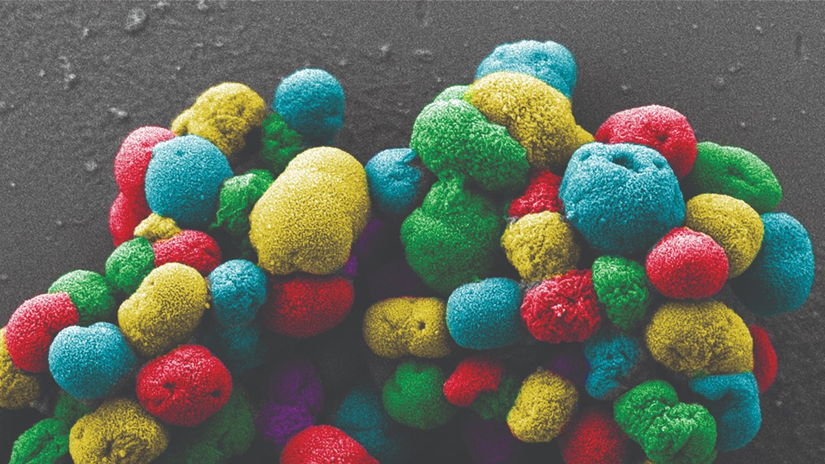 cdnsciencepub's tweet photo. The #CanJMicrobio cover features, via SEM, the imperfect rough spheres of an uncharacterized Neisseriaceae species, a bacteria family often found on the mucosal surfaces of mammals.

📸: @ChenalMartin @inrsciences

Access the journal at https://t.co/vfAhpptRro

13/n https://t.co/7YjbNIuEjN