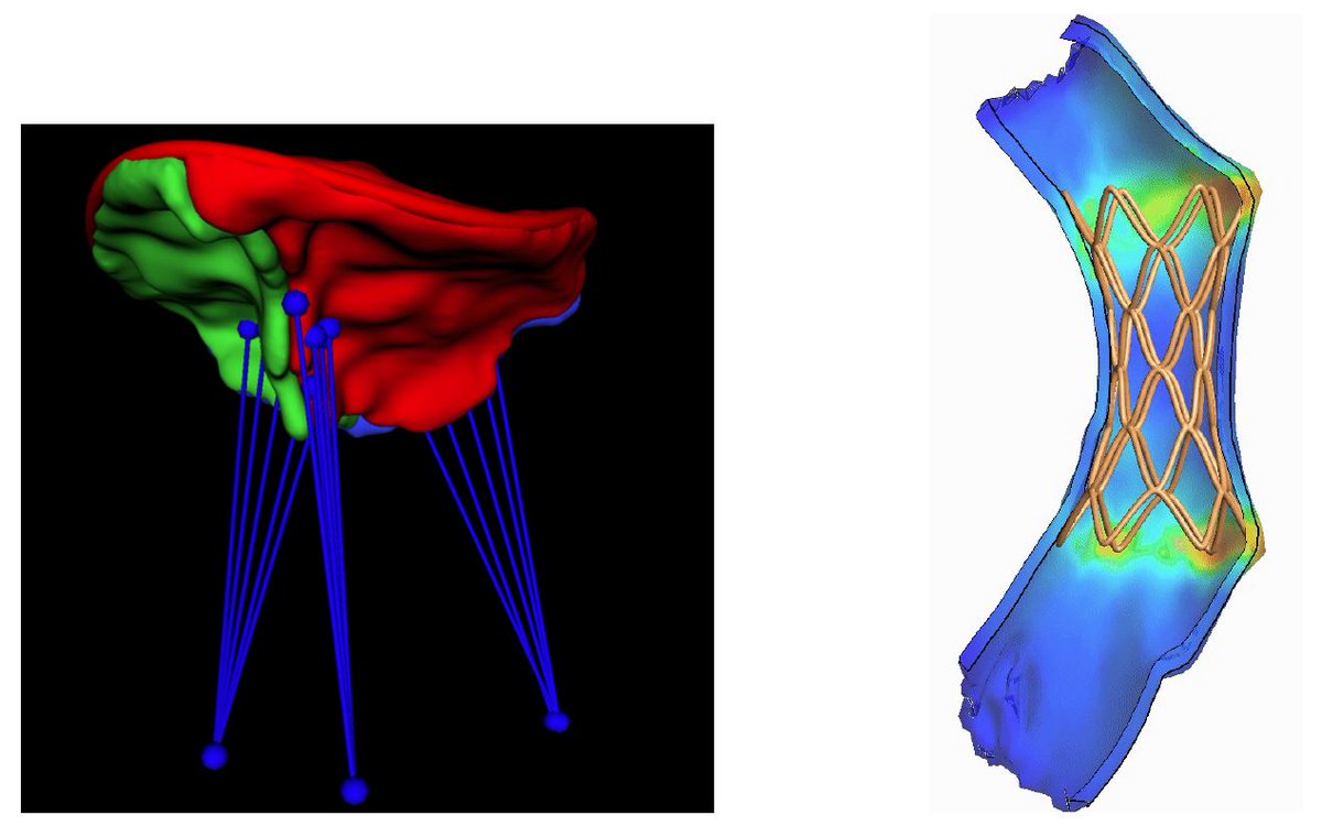 FEBioSoftware's tweet photo. Looking for a postdoc?  The Jolley Lab at Children’s Hospital of Philadelphia is recruiting a postdoc with expertise in computational biomechanics to develop integrative image-based computational modeling of pediatric heart valves. jolleym@email.chop.edu, https://t.co/q8DUMQJxpY https://t.co/vriWwY4xFz