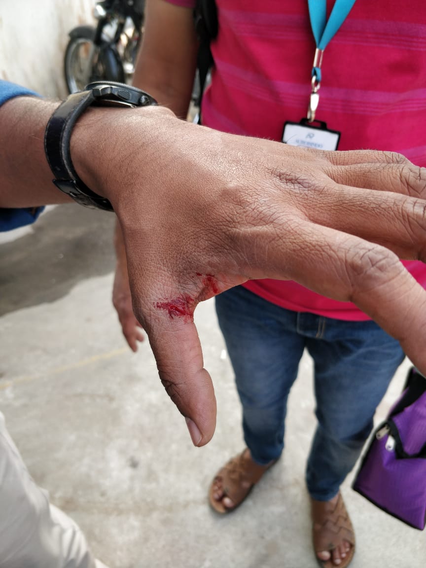 SindhuParupelli's tweet photo. @TelanganaCOPs @KTRoffice @KTRTRS @cyberabadpolice my husband and his colleague are returning to home on bike from office at around 4pm glass powder treated thread or Chinese thread suddenly wrapped around their neck and caused severe injury. https://t.co/GLPIxW3XJA