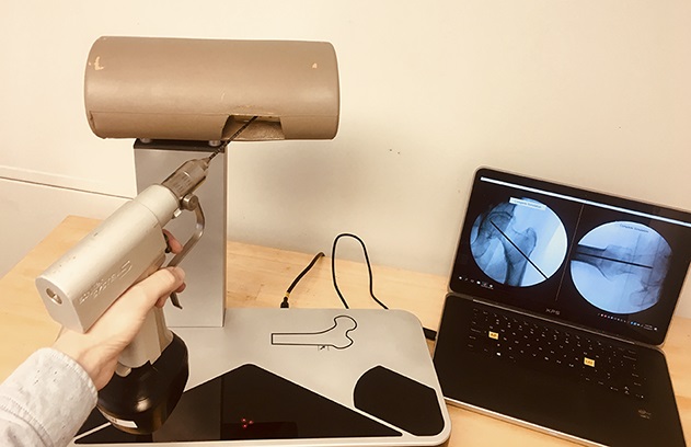 Clinorthop's tweet photo. #Resident skill development can be objectively assessed from #fluoroscopic image sequences by analyzing decision-making through the process of wire navigation
@uihealthcare 
📖 https://t.co/jEO8xiD0Qb https://t.co/yn7ThmISyo