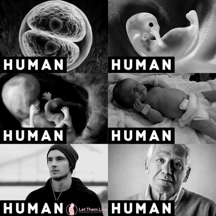 CarlosLeal's tweet photo. Defiendo la VIDA HUMANA en todas sus etapas de desarrollo. 💪🏻

#PrimeroLaVida https://t.co/adtZ58zF1L