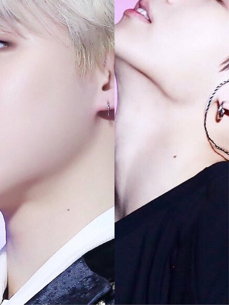 even same mole placement???