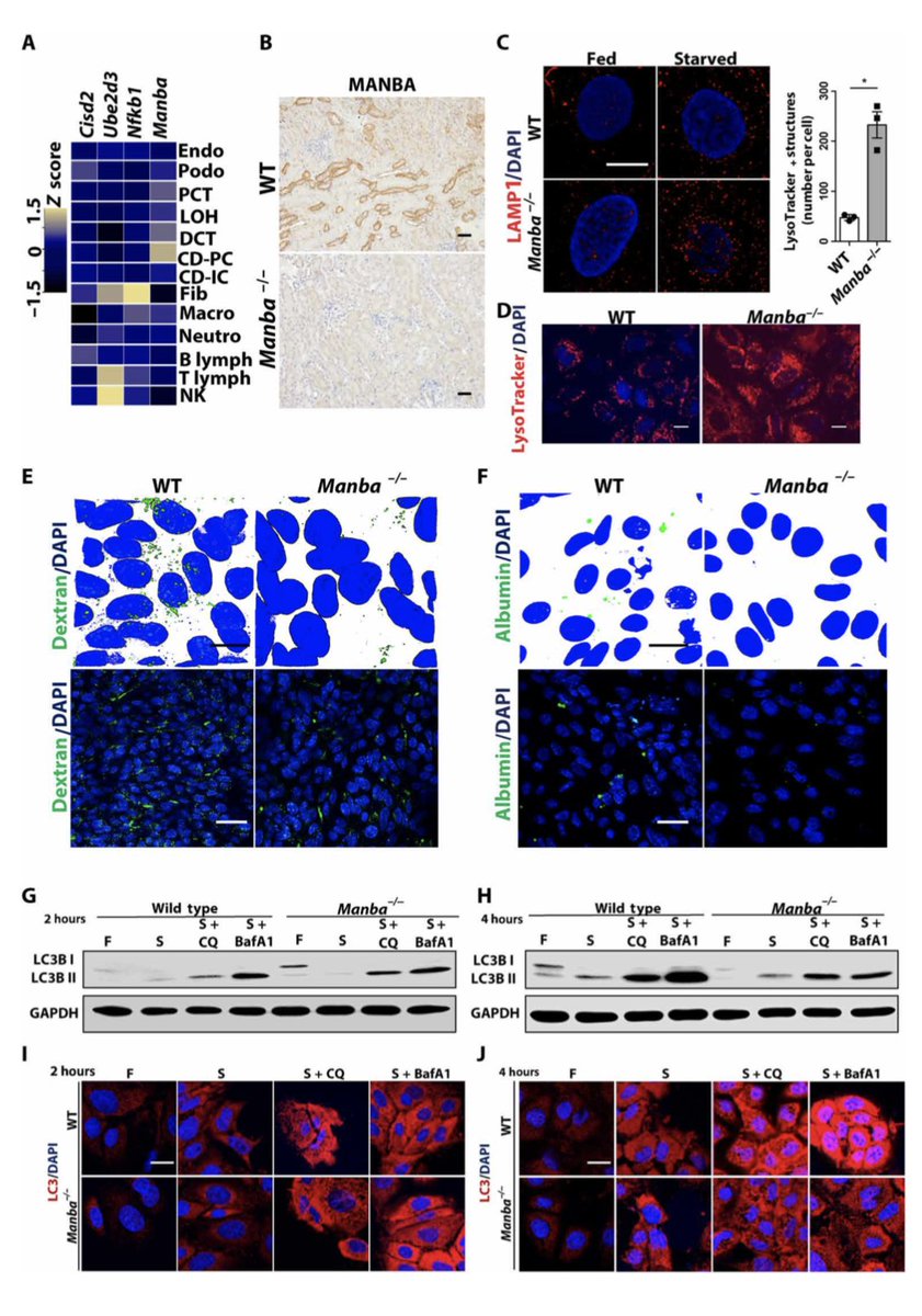 MANBA deficiency causes structural and functional lysosomal changes, a block in autophagy and endocytosis defect in kidney proximal tubules