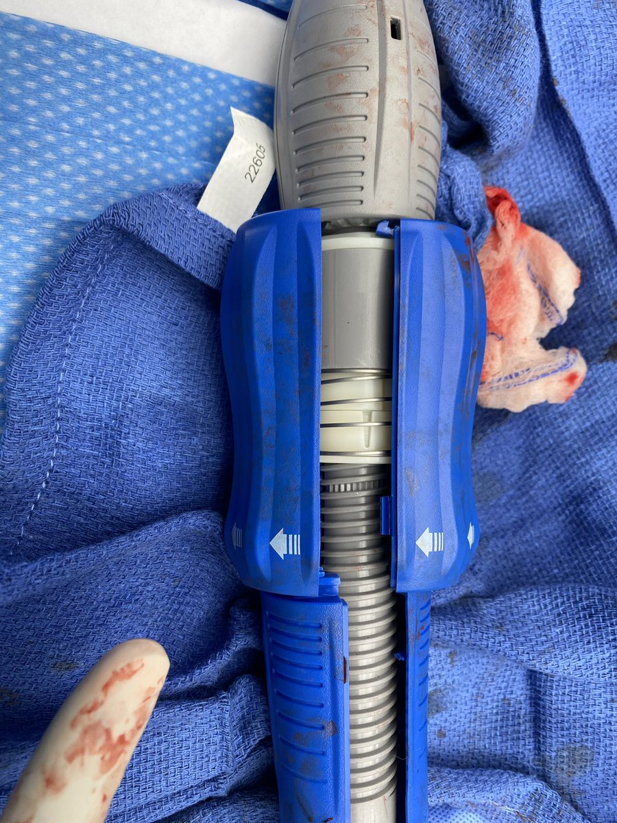 rahilraf's tweet photo. Disaster Averted!!! The delivery system broke as I was trying to recapture @Medtronic 29 Pro+ valve. Valve not fully captured and had to manually pull it into the sheath before removal. Anyone witnessed this? @ajaykirtane @mmamas1973 @GilbertTangMD @ShariqShamimMD @jtsaxon https://t.co/f7ZQ27Yalz