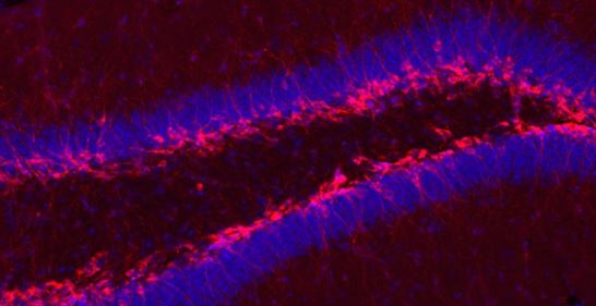 UQ News (@uq_news) on Twitter photo A study from <a href="/QldBrainInst/">Queensland Brain Institute, UQ</a> has revealed how exercise increases neurogenesis, the creation of new brain cells that play crucial roles in regulating mood, memory and spatial learning.
bit.ly/35DJgHI A study from <a href="/QldBrainInst/">Queensland Brain Institute, UQ</a> has revealed how exercise increases neurogenesis, the creation of new brain cells that play crucial roles in regulating mood, memory and spatial learning.
bit.ly/35DJgHI