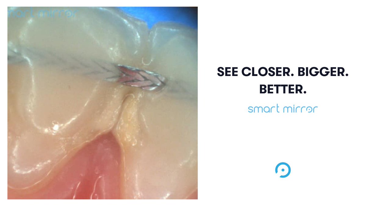 Ready to trade in that old mirror for #SmartMirror?  👉smartmirror.dental/pre-order 

#CloserBiggerBetter #Innovation #intuitive #TrueColorLight #Technology #Tech #IntraOralCamera #EndoscopicCamera #DentalSmartMirror #intuitive #SmartDentistry