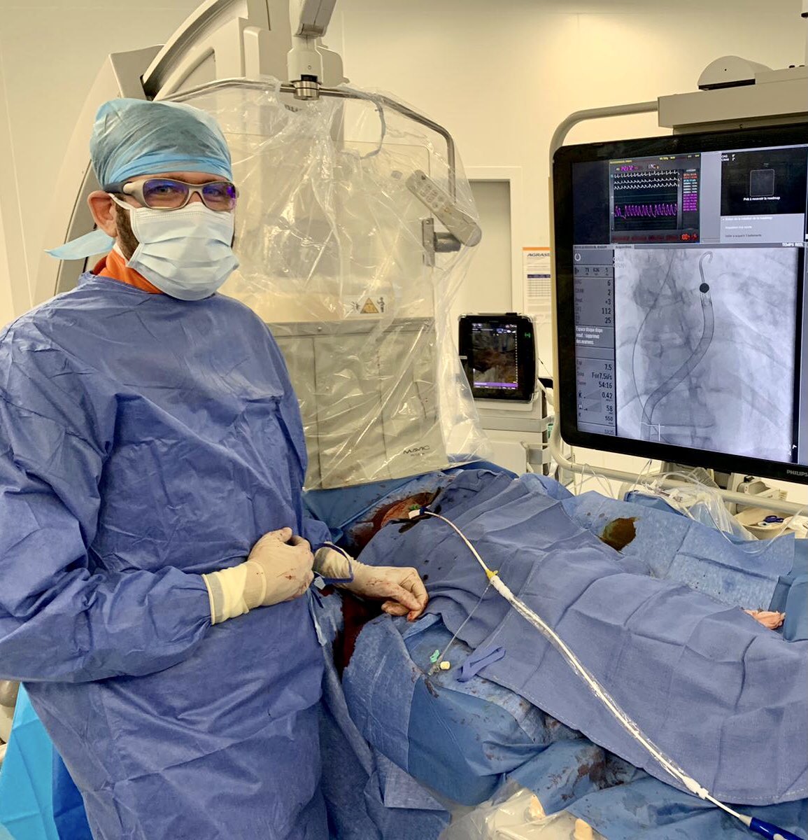 First #Impella RP implantation for refractory RV #cardiogenicshock at <a href="/CHU_Lille/">CHU de Lille</a> ! A less invasive approach for these patients with a potent hemodynamic effect!!! <a href="/Flavien_Vincent/">Flavien Vincent</a> <a href="/Eric_Van_Belle/">Eric Van Belle</a> <a href="/cedricdelhaye1/">Cédric Delhaye</a> <a href="/basile_verdier/">Basile verdier</a> <a href="/porouchani/">Katayoun Porouchani</a> <a href="/CosenzaAlessan1/">Alessandro Cosenza</a>