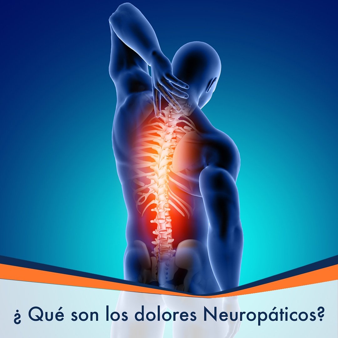 ¿Sabes lo que son los #dolores neuropáticos?

Son el resultado de algún daño o disfunción del sistema nervioso periférico o central. Este dolor está camuflado entre los nervios, es muy difícil de ver, incluso de diagnosticar.

Visita nuestro Instagram para más información