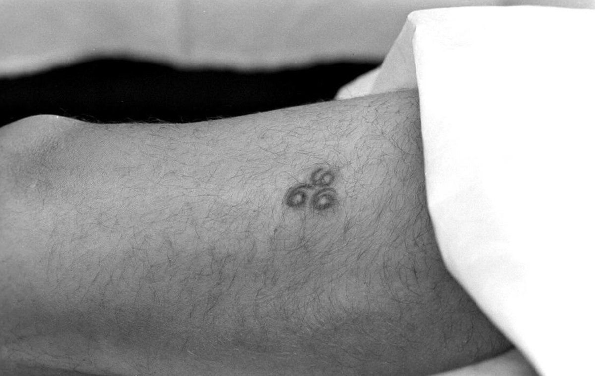 A 666 that seems to have mysteriously appeared on Patrick Troughton’s body (the impaled priest, from the famous church scene). In death, was he somehow claimed by the devil?