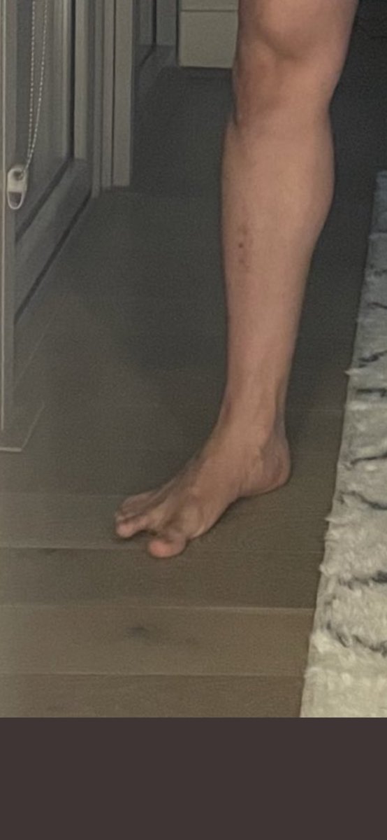 Withlovesindi's tweet photo. @sarahrusinky @Juantwo_3 @rgarza0416 Why you spreading yo toes like that bruh https://t.co/K57eBgWmXm