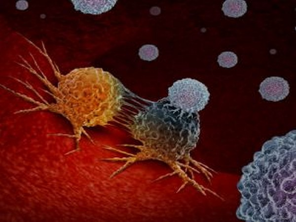 neonatal_med's tweet photo. Gut disease linked to brain injury in premature infants: Study
for more details visit: https://t.co/yTB0RExRKM https://t.co/mEhR13yi5M
