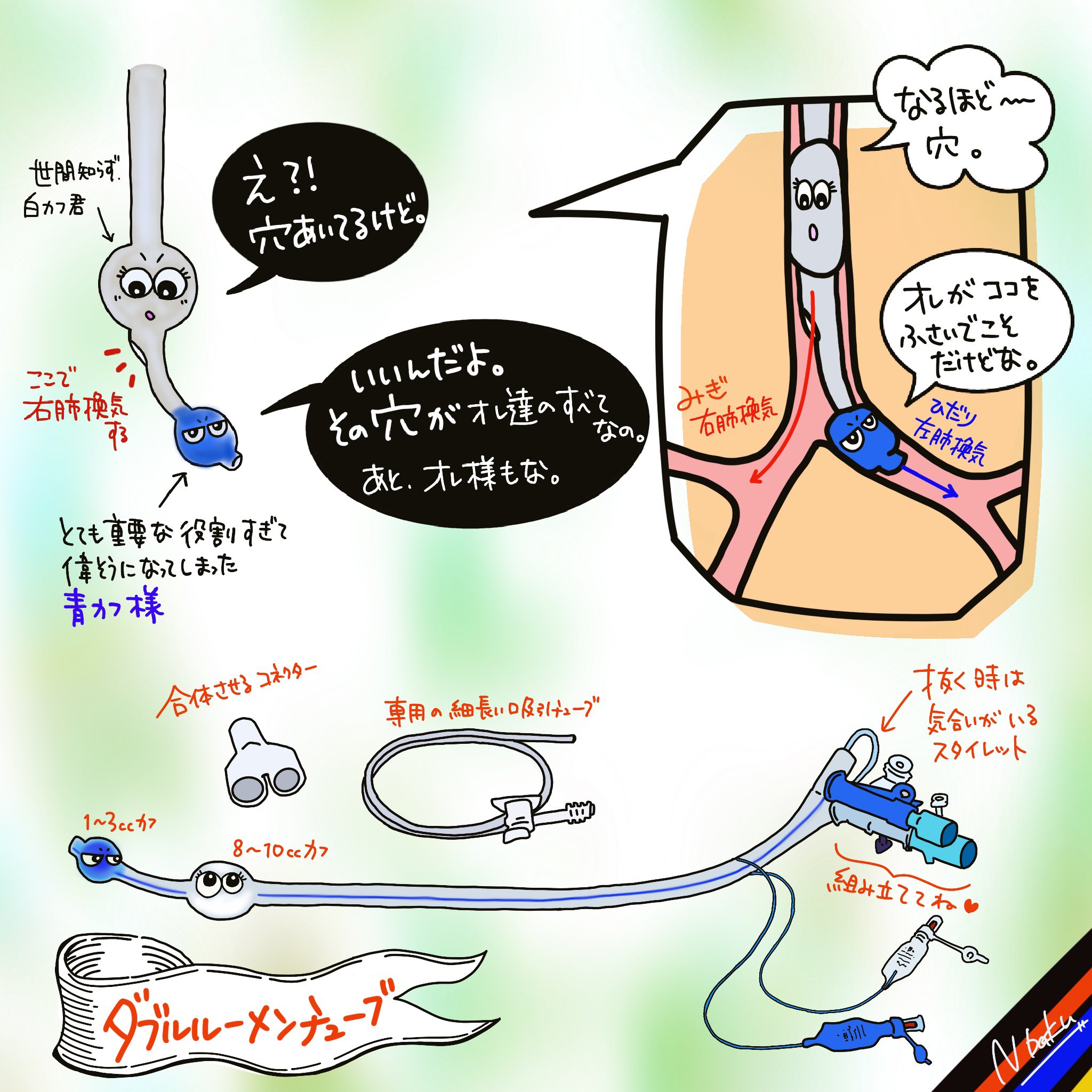 Nバク 働くナースに捧ぐ No Twitter 分離肺換気 再掲 ダブルルーメンチューブ Dlt 肺や食道 下行大動脈の手術等で使用 解剖学的に右肺挿管はリスクが高いので 原則的に左用チューブで左肺挿管を第一選択とします スタイレットを抜く時は 気合いと優し