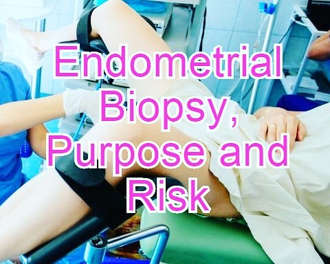 HealthAdvisor99's tweet photo. An #endometrial #biopsy is an examination in which the doctor obtains a small sample of tissue from the lining of the uterus (endometrium). 
https://t.co/1LtIrQ5bjs https://t.co/RtcNymC3CJ