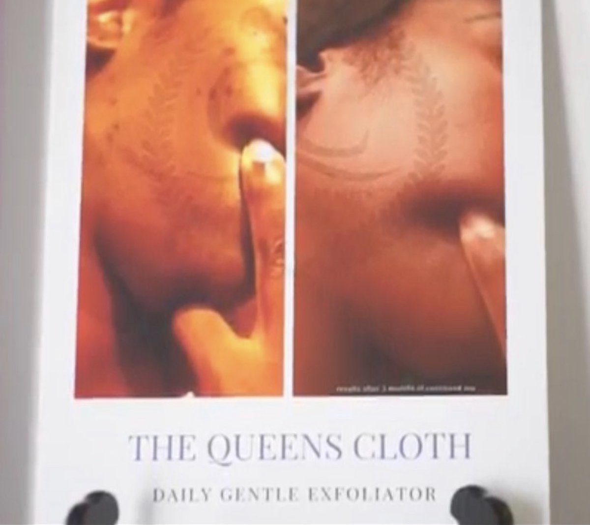 QueenCityBG's tweet photo. We're here to help you see results from exfoliating with The Queen's Cloth ๐ It's an important step towards clear skin!
.
.
.
.
.
.
#beautyinfluencer #queenskin #skincare #pineville #northcarolina #smallbusiness #selfmade #qcbg #esthetician #selfcare #selflove #beforeandafter https://t.co/zX1T2N2ten