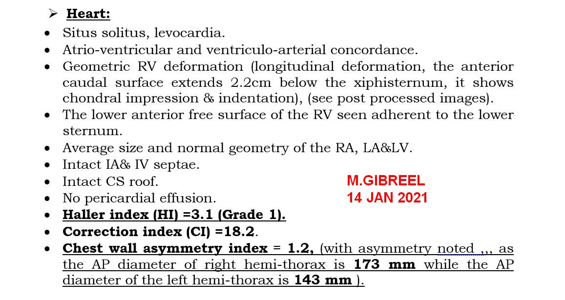 MGibreel1's tweet image. Pectus excavatum (Grade1), with longitudinal deformation of the RV &amp;amp; chest asymmetry,,, important measurements