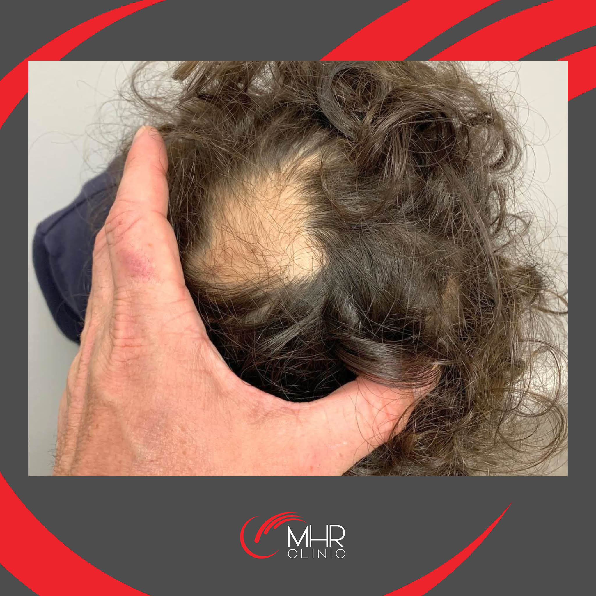 MHR Clinic UK on Twitter: MHR Clinic UK on Twitter:
