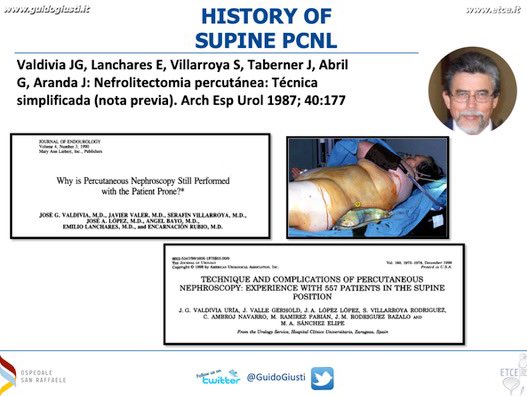 GuidoGiusti's tweet photo. Dear @ValdiviaUria I share with u my mentor this huge satisfaction In the past this was considered impossible 2 happen:in an #PCNL course run by the 🇺🇸 gotha of #endourology also #supineposition is contemplated as an option All credit goes to u 4 ur genial intuition back in 1987! https://t.co/VcDmau1fN3