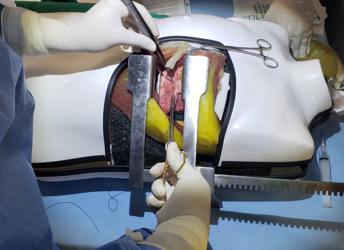 We have high fidelity simulators to teach the technique in ex-vivo models. This is the result of training. <a href="/MartinInzunzaA/">Martin Inzunza</a> was the resident in the case. 👏🏻👏🏻👏🏻🥳🥳🥳 <a href="/AnaliaZinco/">analia.zinco</a> &amp; <a href="/gaboescvi/">Gabriel Escalona Vivas</a> part of <a href="/traumasotero/">Traumasotero</a> and <a href="/SimulacionUC/">SimulacionUC</a>
<a href="/franbelmar93/">Fran Belmar</a> #simulation