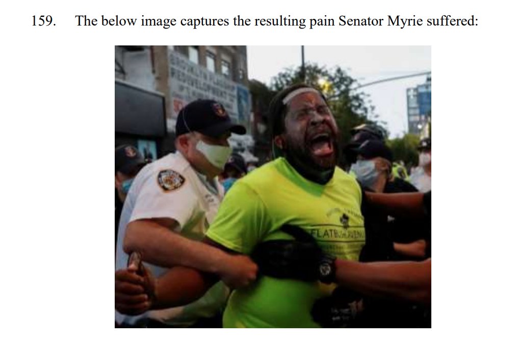 *This* is NY state  @SenatorMyrie after he was pepper-sprayed, slammed with a bike, and falsely arrested. "Although Senator Myrie was screaming in pain, NYPD Officers did not seek or provide him with any medical treatment until one passing officer recognized him."