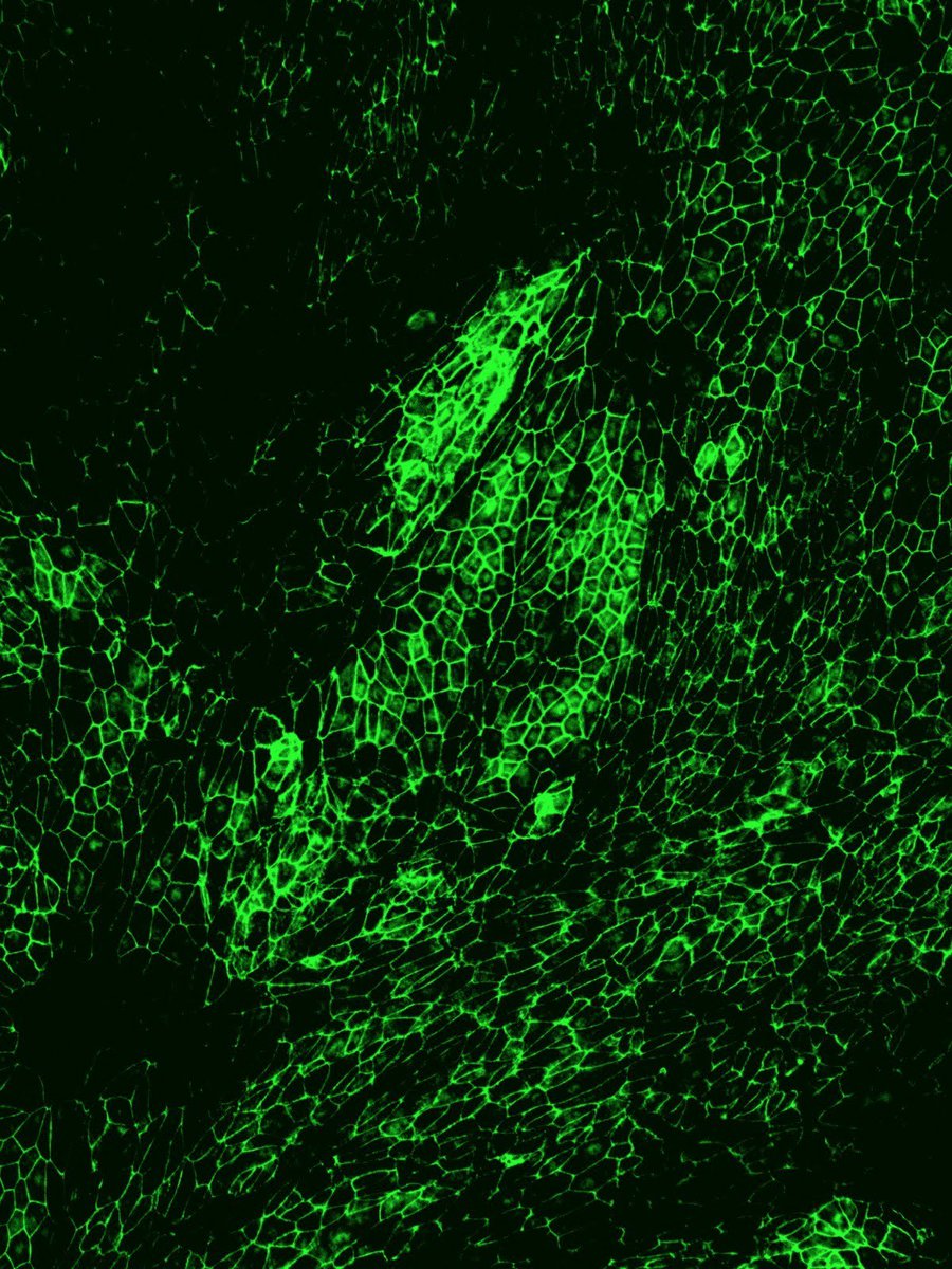 DrRohiniNair's tweet photo. Cells try to talk other cells into joining their bunch. A lone cell doesn't usually survive unless they are embryonic stem cells or cancer cells. Apparently, introverted behaviour don't seem to bode well with adult cells.
#sharingiscaring #noprivacy #celltalk https://t.co/HOuQNVZuIJ