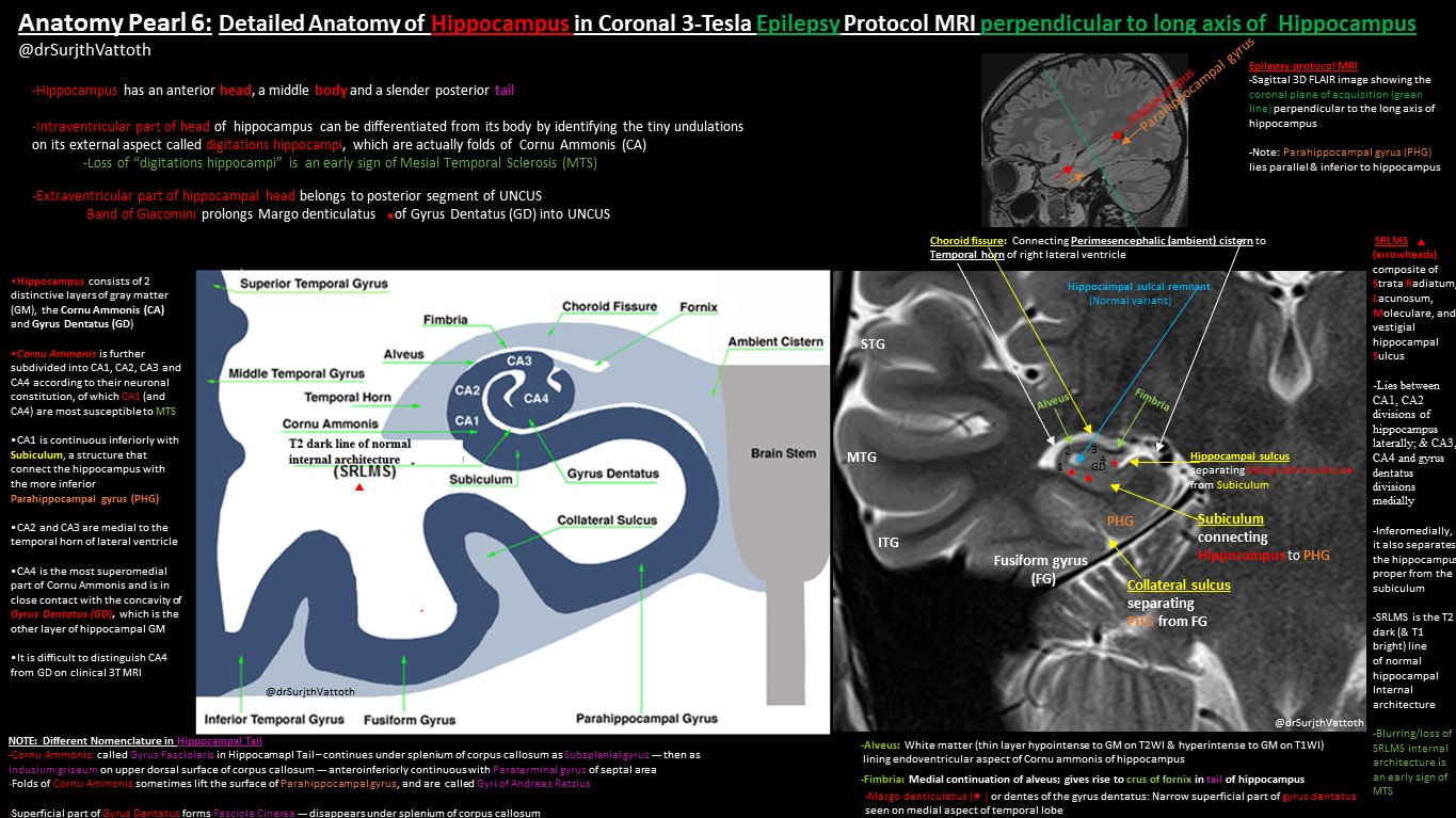 Повреждение гиппокампа. Гиппокамп мрт анатомия. Гиппокамп строение мрт. Зубчатая извилина гиппокампа мрт. Анатомия гиппокампа на мрт.
