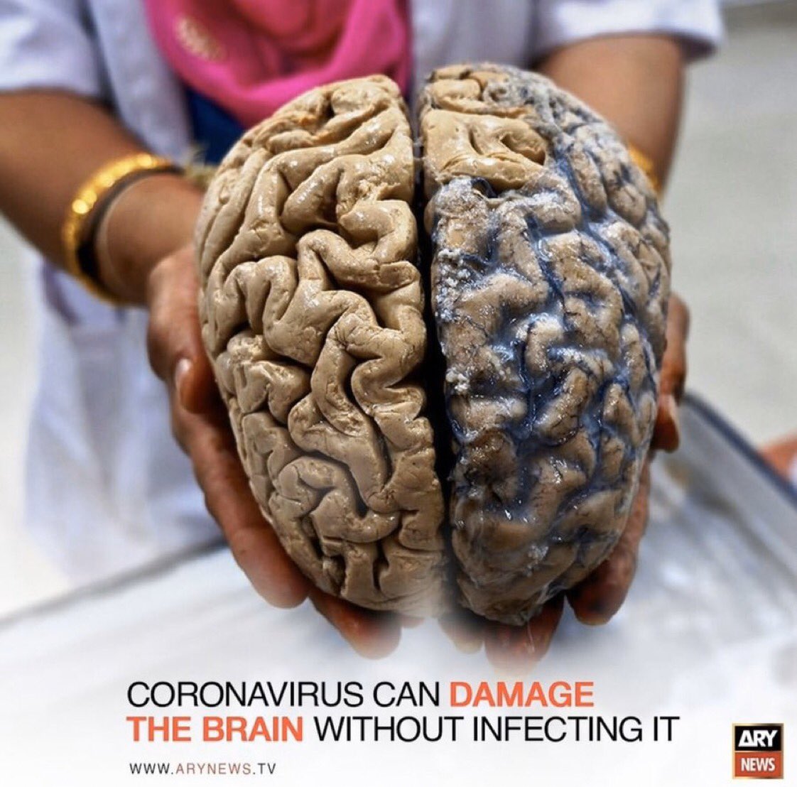 мозги в реальности