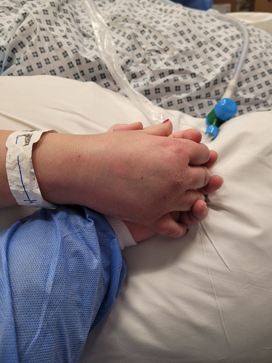 My beautiful mum passed away today from #COVID, after only 5 days. She was 51. I was lucky to be allowed onto critical care and hold her hand to the end. Please retweet this to ensure others stay safe and take this virus bloody seriously. Sleep well mama 💓 #CovidUK #COVID19