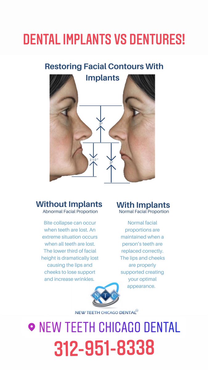 Newteethglobal's tweet photo. https://t.co/p8lz0VEqC9