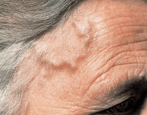 Global Pharmacist tweet media