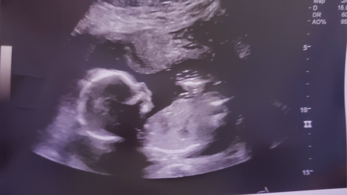 Mrs Hewitt 🇨🇦 🇲🇹 tweet media