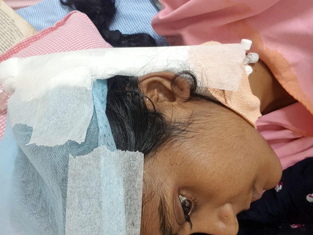 Prathib77972783's tweet photo. @KTRTRS Good mornig dear sir/madam
This is Vadluri.Pavithra,Aeo, Rajura,Lokeshwaram mandal
Ma own sister,Vadluri.Swathanthra ki liver damage aindhi 
Doctors 6 weeks lo liver transplant cheyali annaru
Dear frds pls help to my family financially 
The operation cost is 28 lakhs https://t.co/5GttlhABFo