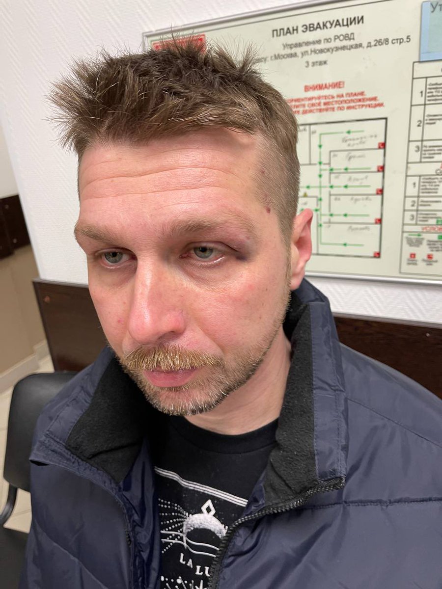 vigimadi's tweet image. Оператора ФБК Павла Зеленского избили, ударили по голове, изъяли на обыске ноутбук и телефон. За непонравившееся власти мнение по общественно-политическим вопросам. Сообщают адвокаты «Агоры». Сейчас он в ГСУ СК по Москве с адвокатом.