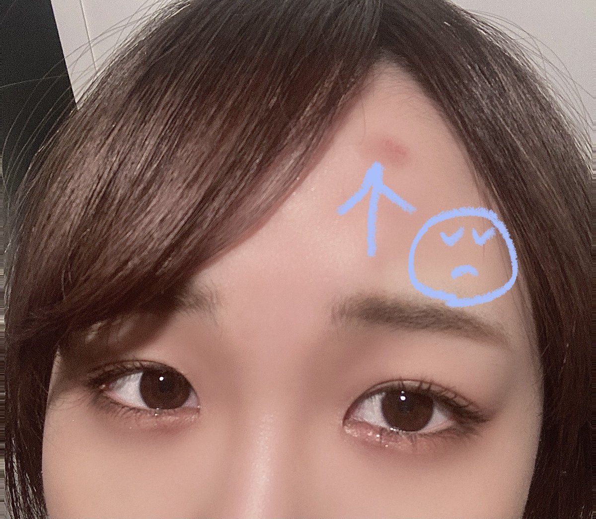 三田麻央 コテでやけどした しょんぼり 三田麻央 コテでやけどした しょんぼり