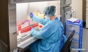 d) during handling of the sample in the lab 8/n