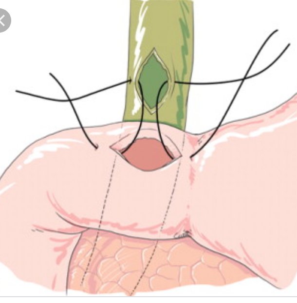 anniaramosperez's tweet photo. Thanks🙏🙇 for your help my love❤😘 @lvazxman and of course our wonderful team of anesthesia guide by @Maritza03510092 👏👏👏👏. https://t.co/Gy9aAbaLpT