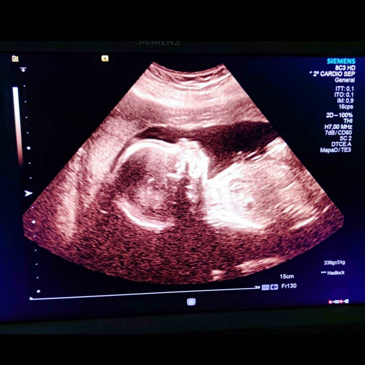 JuanitoMonroy11's tweet photo. Y cuando menos te lo esperas los sueños se cumplen.. #bebedepapi #Hugo 👶🏼👩🏽🦱❤️ https://t.co/ju74MUToV0