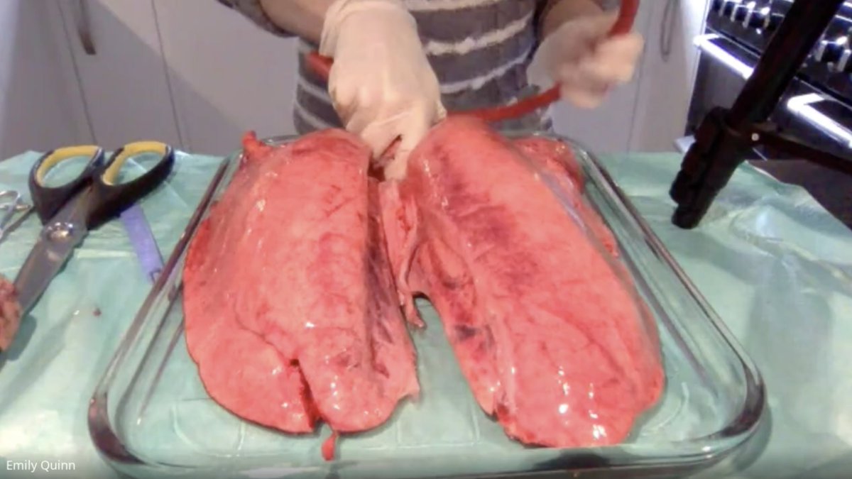 ScienceBHGirls's tweet photo. Who says lockdown has to stop practicals?! Remote lung dissection with Year 7s. More of a challenge without a scalpel but Scientists can always find a solution! https://t.co/oFZ3lnNAAn