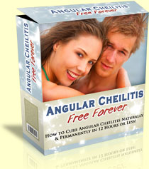 weightloss3728's tweet photo. “Professors Predicted I Would Never Cure My Angular Cheilitis. But Contrarily to their Prediction, I Cured It Easily, Permanently &amp; In a Few Hours! I'll Show You How...”
 -- Jason White  
 
C lick here for information👉👉 https://t.co/R8msximmDv
#AngularCheilitis https://t.co/XvWVhzP2hz