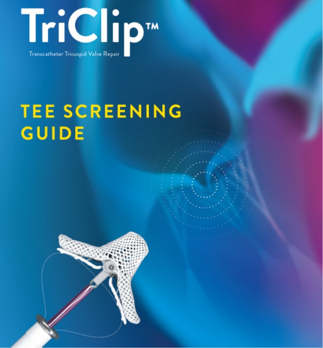 vonBardelebenRS's tweet image. #TriClip #TEE #ScreeningGuide available for #download #Abbott and #Heartvalvecenter_Mainz developped this for use outside the US #hotoffthepress2021 @vonBardelebenRS @YoungDgk @GilbertTangMD  LINK: linkedin.com/in/von-bardele…