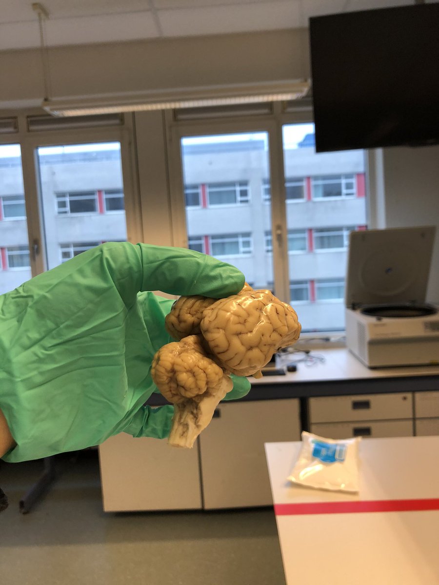 KealPsych's tweet photo. Today I conducted a sheep brain dissection as part of my Neuroanatomy skills practical. We particularly examined the hippocampus &amp; basal ganglia 🧠 What a cool experience it is to inspect the brain’s structures in real life ✨#neuro #brain #neuropsych https://t.co/Cpw0GnA2Nv