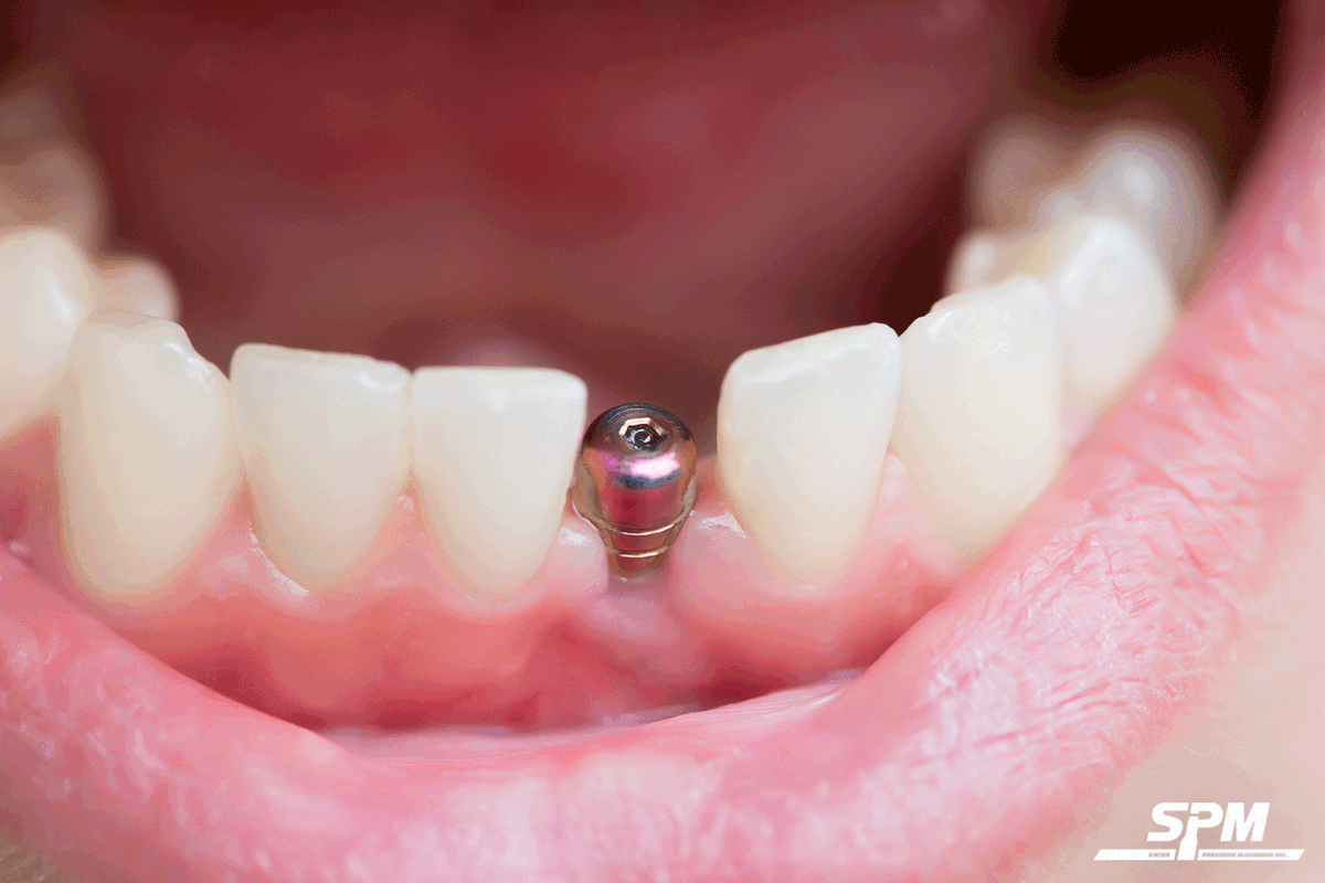 Tooth loss affects speech, eating ability, and appearance. Dental implants and abutments significantly improve a patient's quality of life. Visit our LinkedIn page to read the entire article. linkedin.com/company/swiss-…

#dentalimplants #dentalabutments #dentalmachining #cncmachining