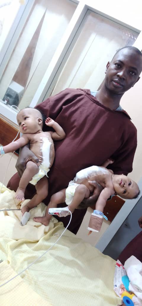 Heartwarming news of the successful separation of conjoined female twins at the University of Ilorin Teaching Hospital (UITH), yesterday. Can anyone pls confirm that these photos circulating on social media are from that surgery?