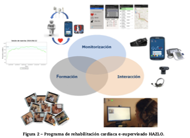 Nueva era en reh cardiaca: e-rehabilitación. Gracias a U Investigación Salud Digital del I. de Salud Carlos III y a equipo RCardiaca de H.U.Ramón y Cajal, el programa e-supervisado ha mantenido una asistencia sanitaria de calidad durante el confinamiento
reccardioclinics.org/es-seleccion-l……