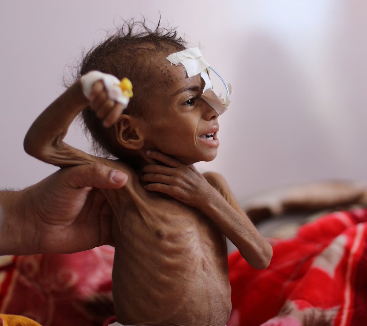 Yémen 🇾🇪 💔