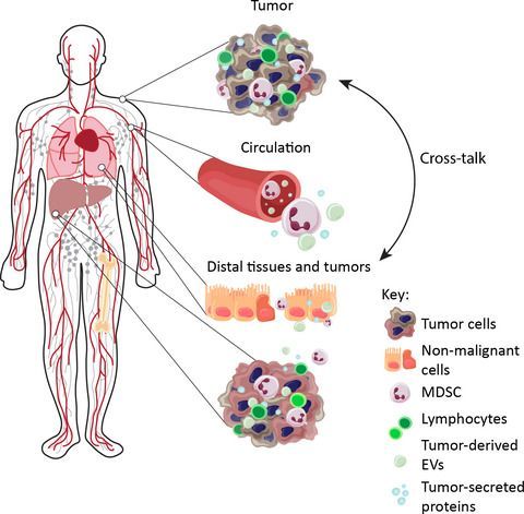 FEBSJournal's tweet photo. 🔎 Viewpoint Article - Cross‐talk between tumors at anatomically distinct sites 🔍 

Featured on the cover of Issue 1! Check out this informative piece from Clare Y. Slaney and co-authors from @PeterMacCC

🔗https://t.co/52NBwW8OmC 
#abscopaleffect #immunotherapy #tumorcrosstalk https://t.co/wzK6YcNtHr