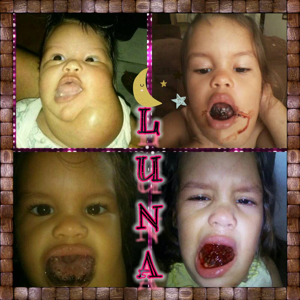 jose3045's tweet photo. Luna necesita mucho de nuestra ayuda para reunir el dinero unamos esfuerzos para que puedan donar y así luna del valle este bien 
@ManosporVen @_Futbolero_ @ManuelConecta @fundacionmessi @RadioFCB @Pedri @SorzharysRios 
👇👇👇Entra-colabora👇👇👇
https://t.co/UG6i89fTqi https://t.co/WS1VlmYDXl