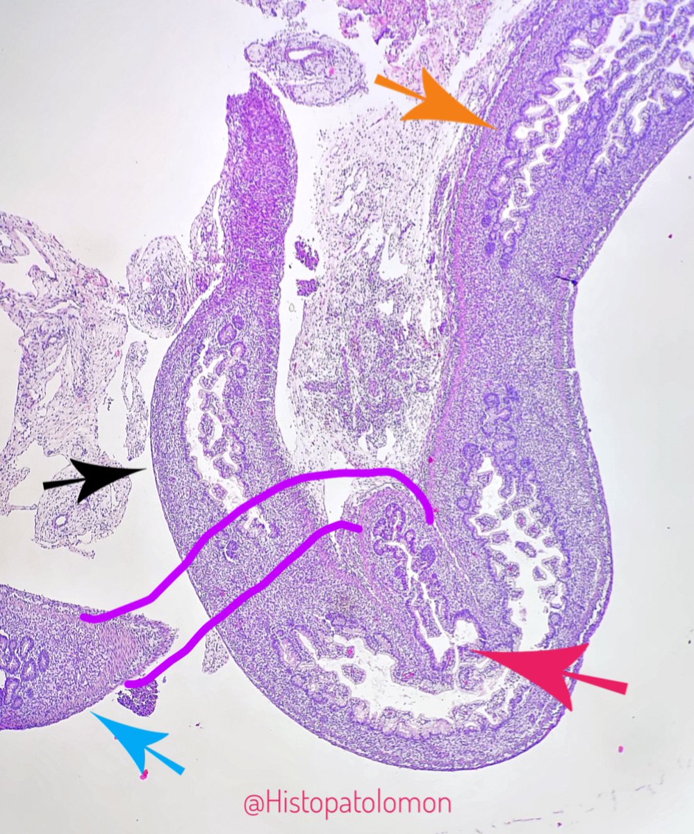 The correct official answer is: No, NoIsolated lymphoid follicles appear at 15-21 weeks and Peyer's patches at 25-29 weeks. As you can see, there is no muscularis mucosae (week 20) but there are goblet cells (week 7)colon (orange), ileum (blue), appendix (black), valve (red)